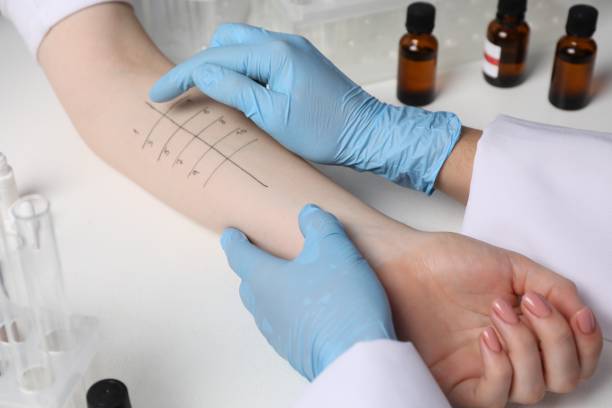 Alergología en Aljarafe