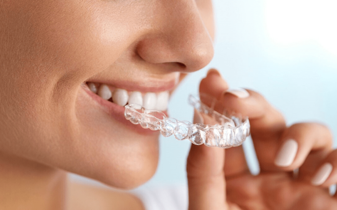 Ortodoncia invisible en Aljarafe