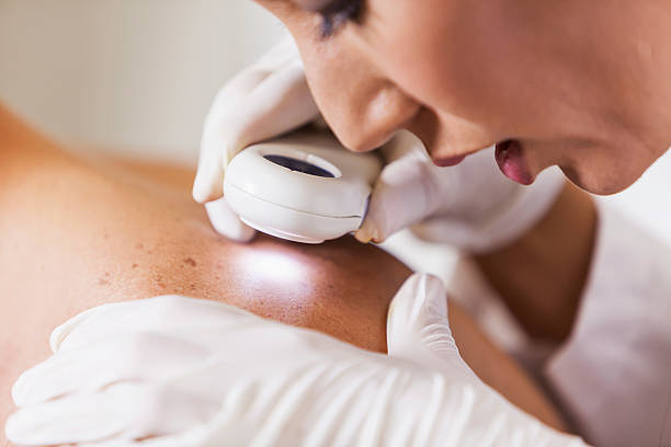 Dermatología en Aljarafe